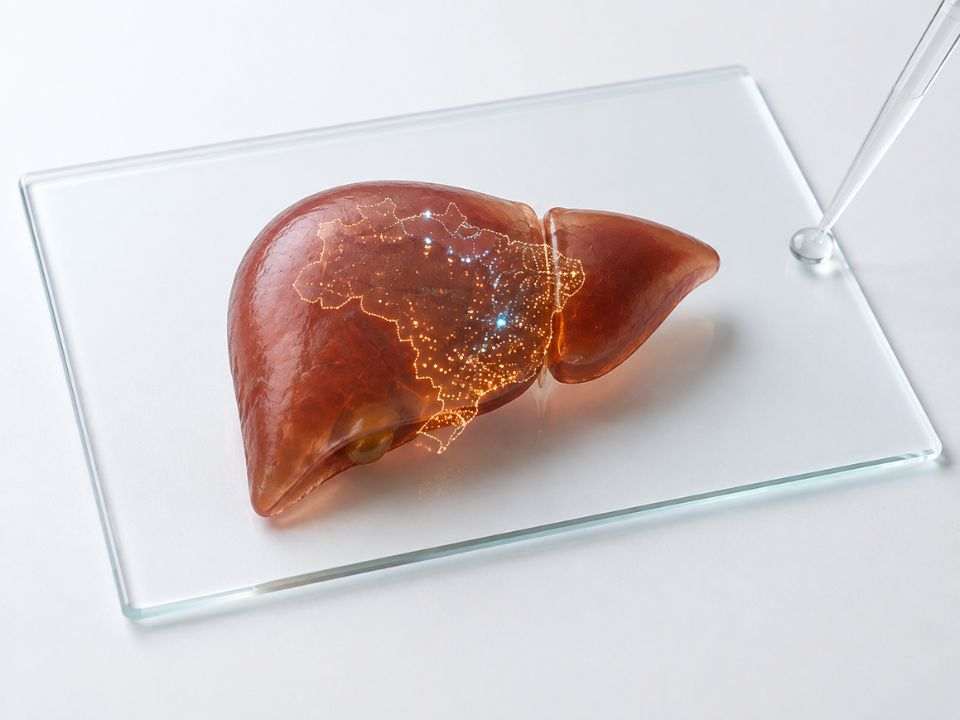 Fígado translúcido sobre lâmina de microscopia com mapa do país, representando o panorama das hepatites virais no Brasil.
