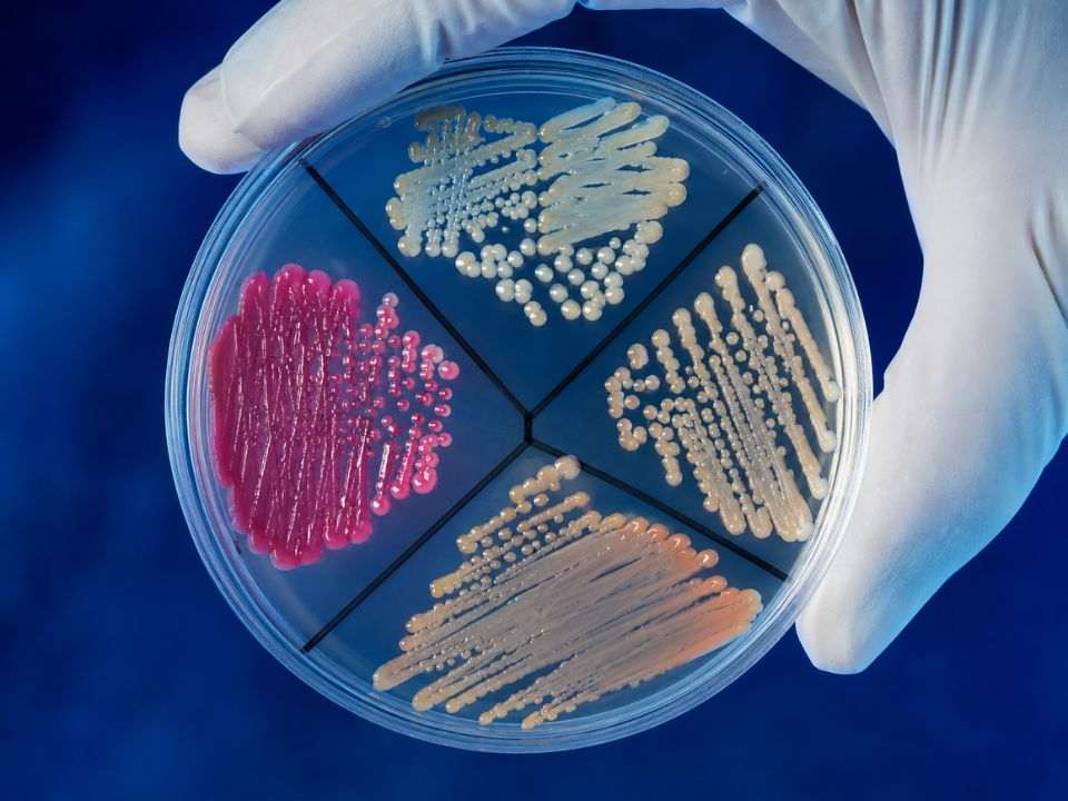Análise laboratorial para identificação de microrganismos relacionados à resistência antimicrobiana.