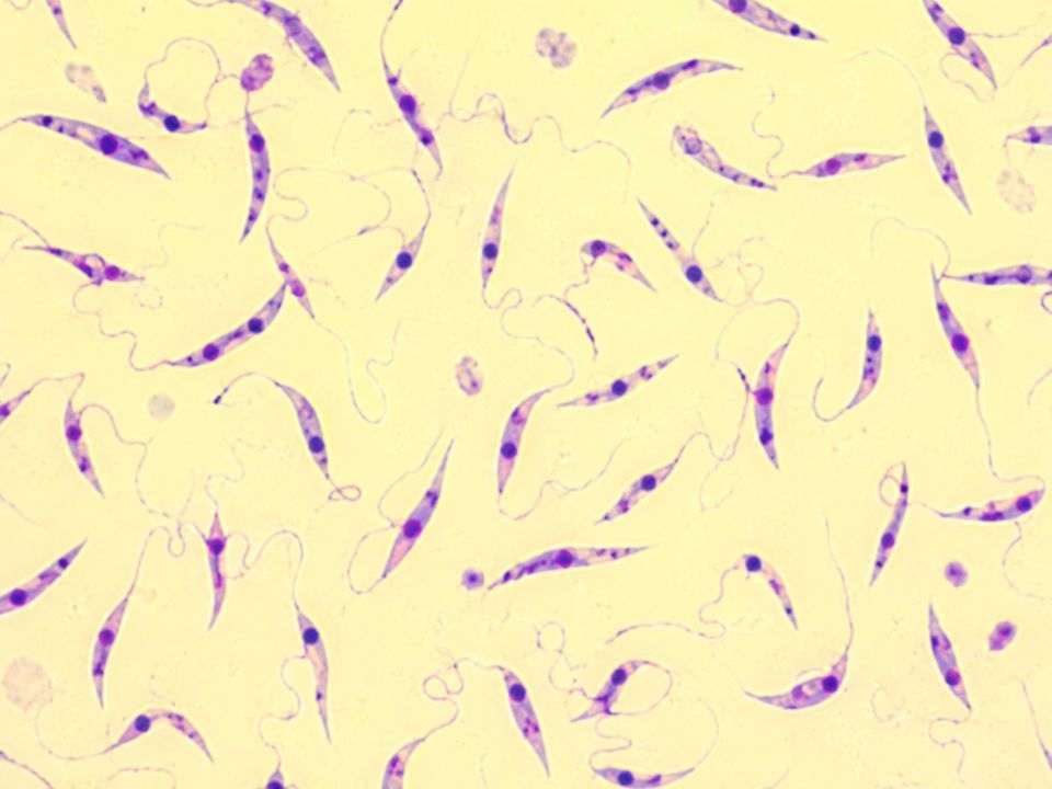 Diagnóstico da leishmaniose em imagem microscópica com formas promastigotas de Leishmania coradas em violeta.