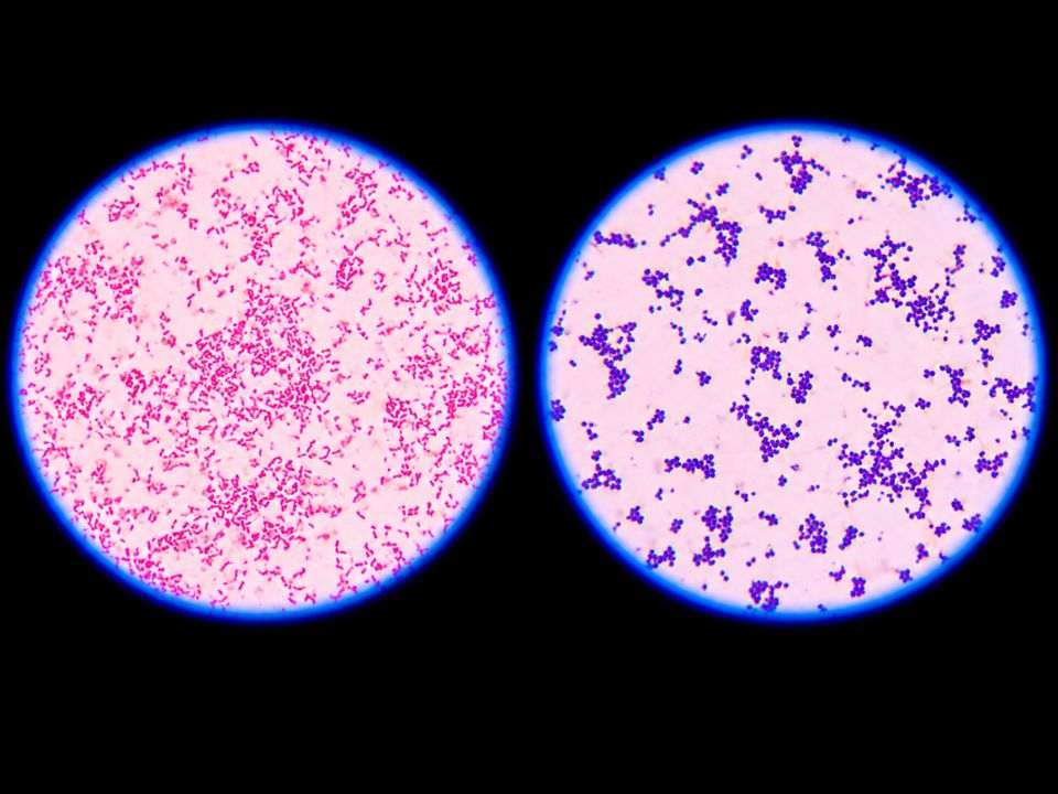 O painel molecular para hemoculturas fornece resultados em cerca de uma hora e amplia a análise de bactérias gram-negativas após a detecção de crescimento microbiano.