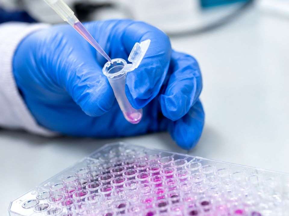 Mão com luva azul manipula pipeta e microtubo sobre uma microplaca, em imagem ilustrativa de pesquisa sobre teste portátil para arbovírus.