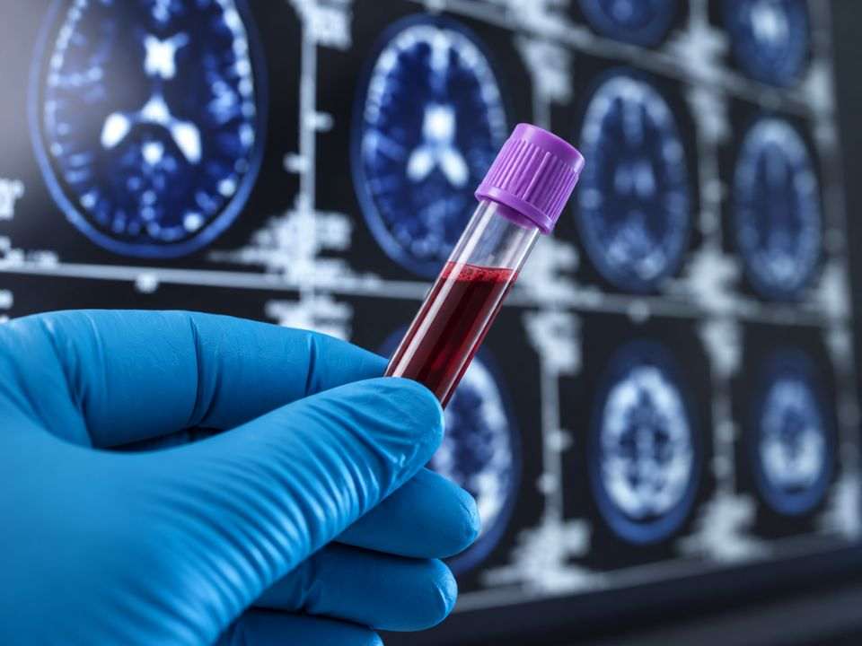 Biomarcadores para AVC, o que falta para chegar à prática clínica.