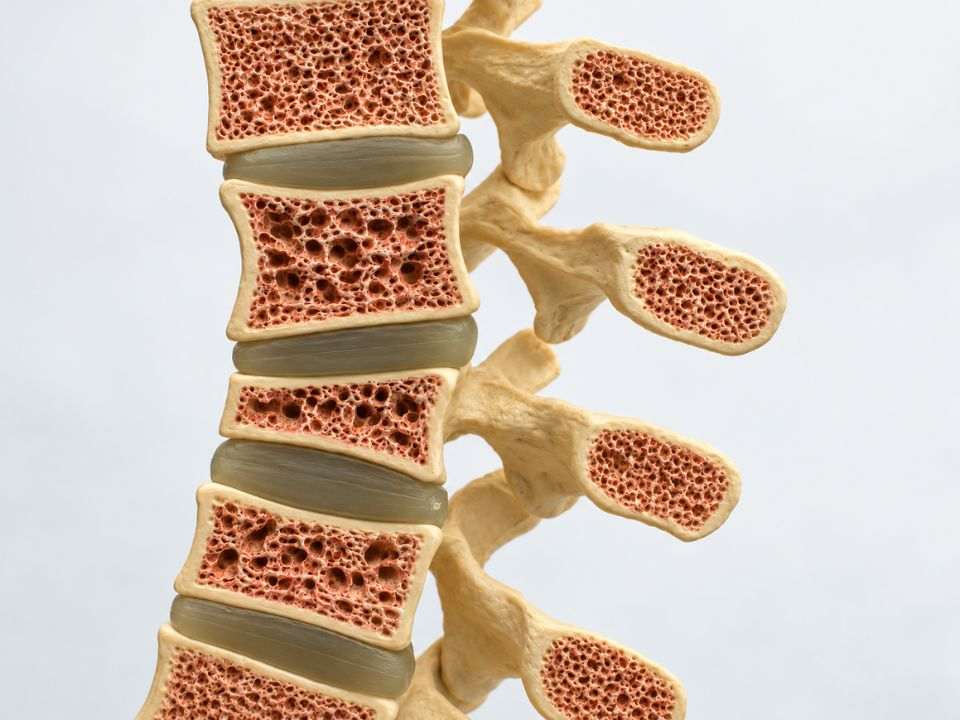 O diagnóstico precoce da osteoporose é fundamental para identificar o risco de fraturas e orientar o acompanhamento clínico.